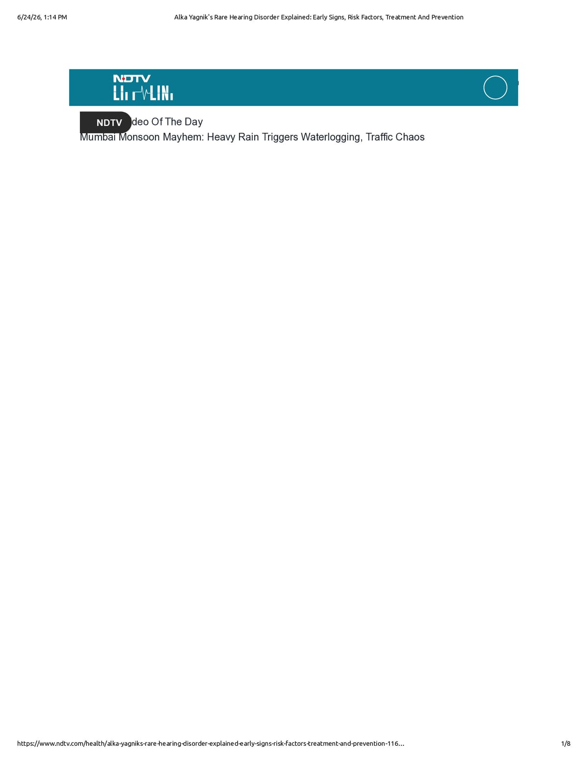 Native browser print preview