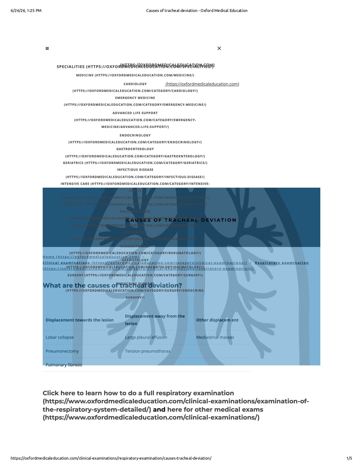 Native browser print preview