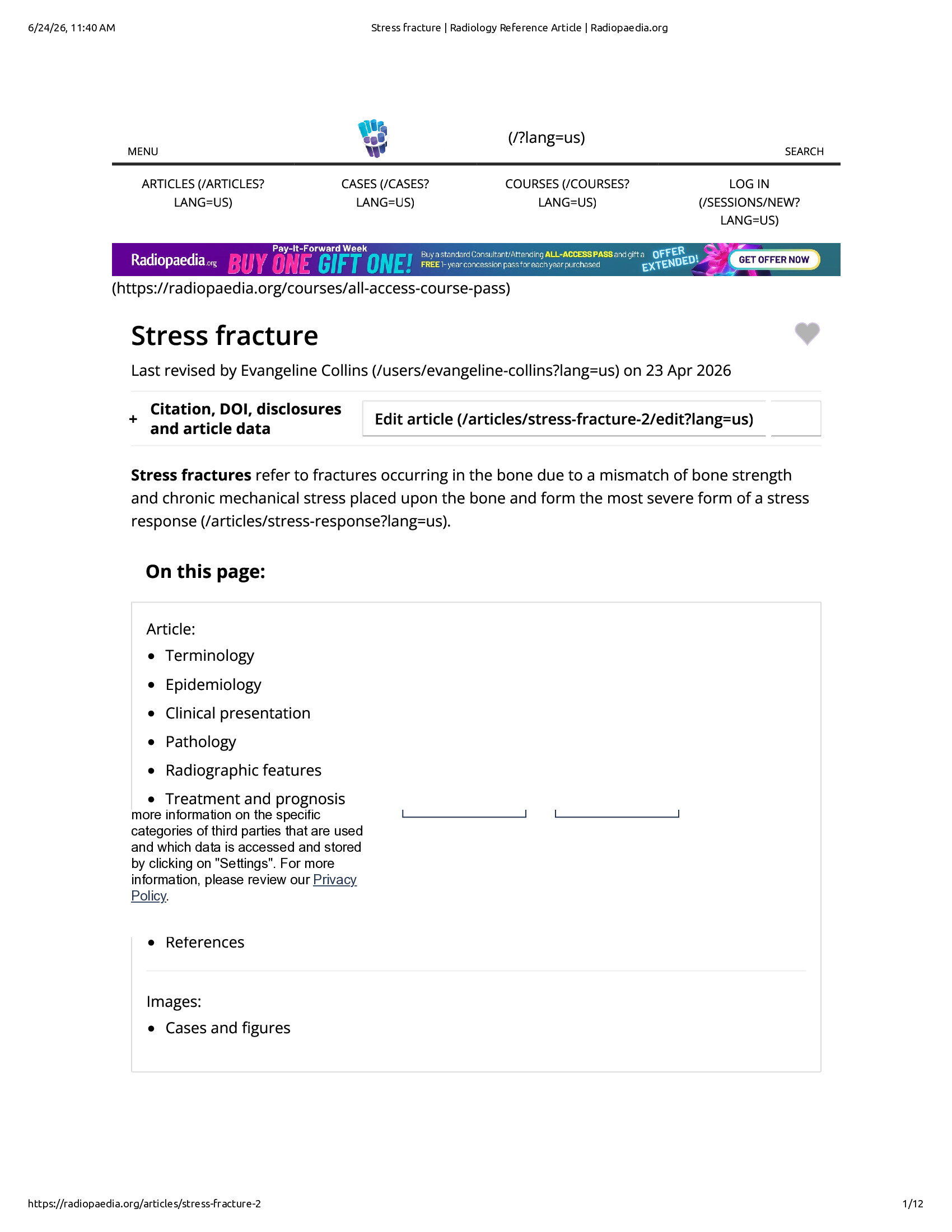 Native browser print preview