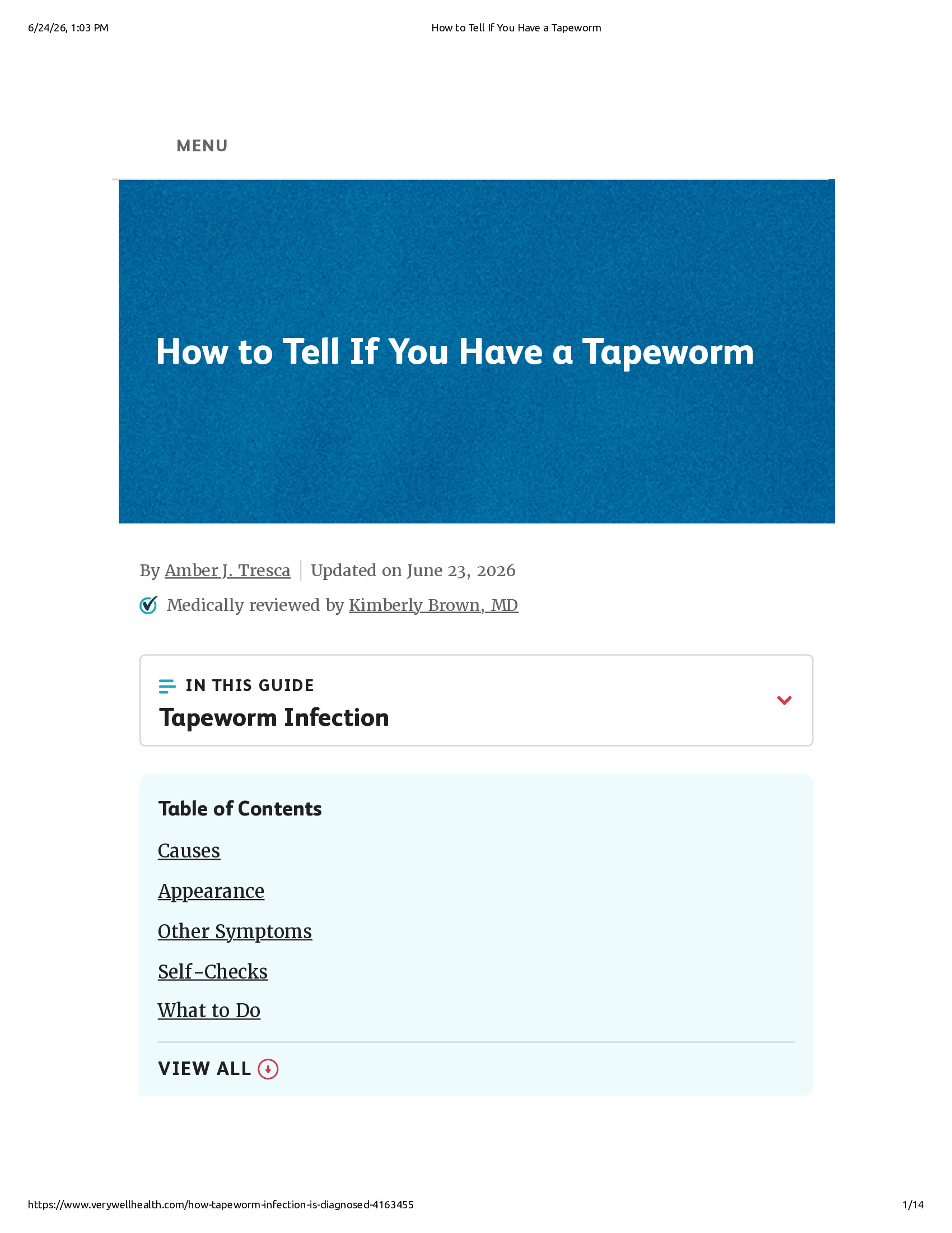 Native browser print preview
