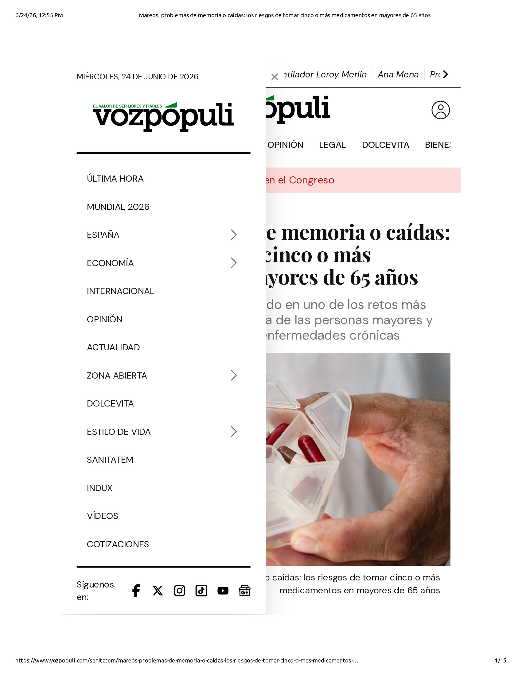 Native browser print preview